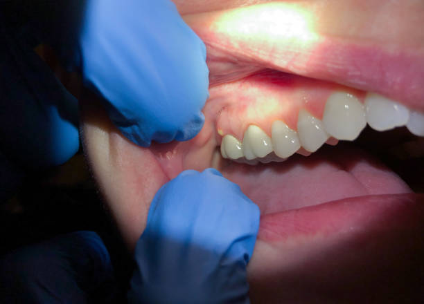 Best Cracked Tooth Emergency Dentist  in Crewe, VA