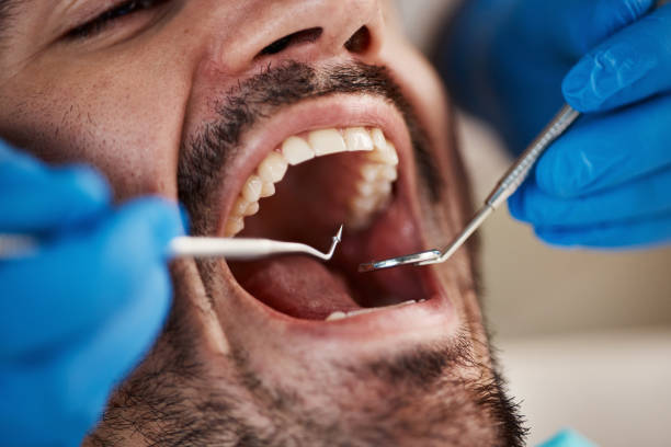 Best Cracked Tooth Emergency Dentist  in Crewe, VA