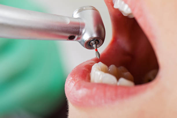 Best Tooth Infection Emergency Dentist  in Crewe, VA